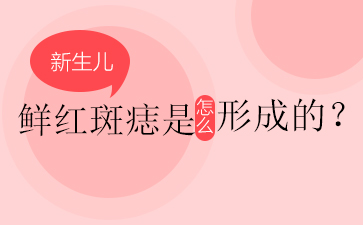 广州去红胎记医院-鲜红斑痣可以根治吗？